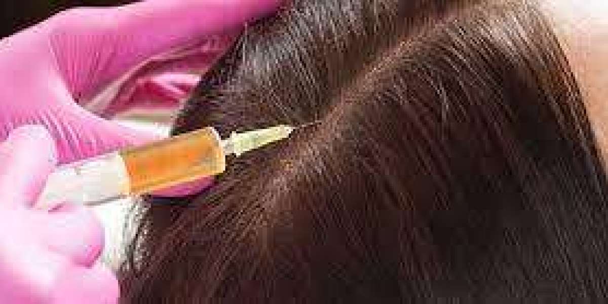 Dubai's Hair Renaissance: Discover the Transformative Power of PRP Therapy