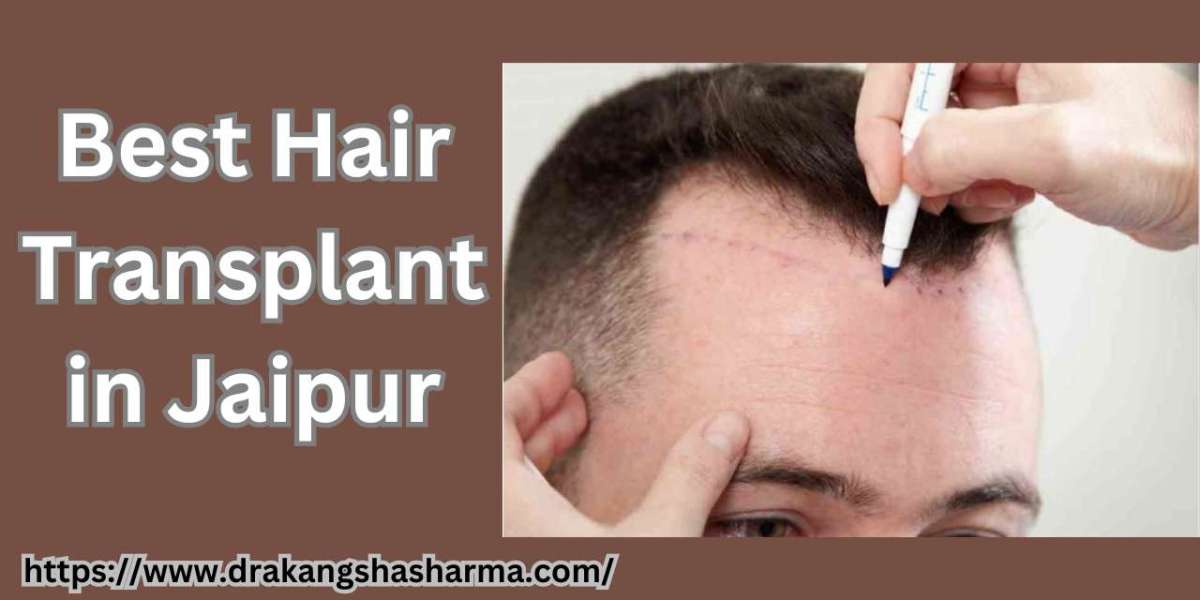 Hair Transplant For Traction Alopecia