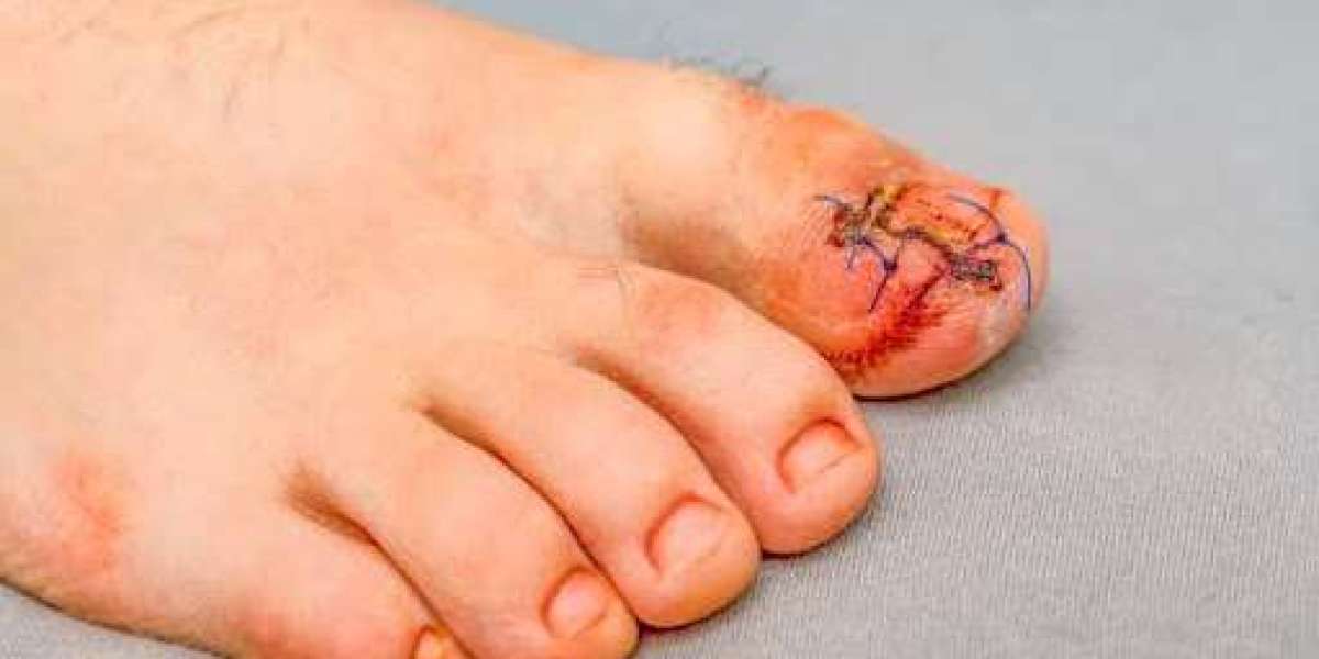 Where to Find Top-rated Toe Shortening Surgery in Scottsdale?