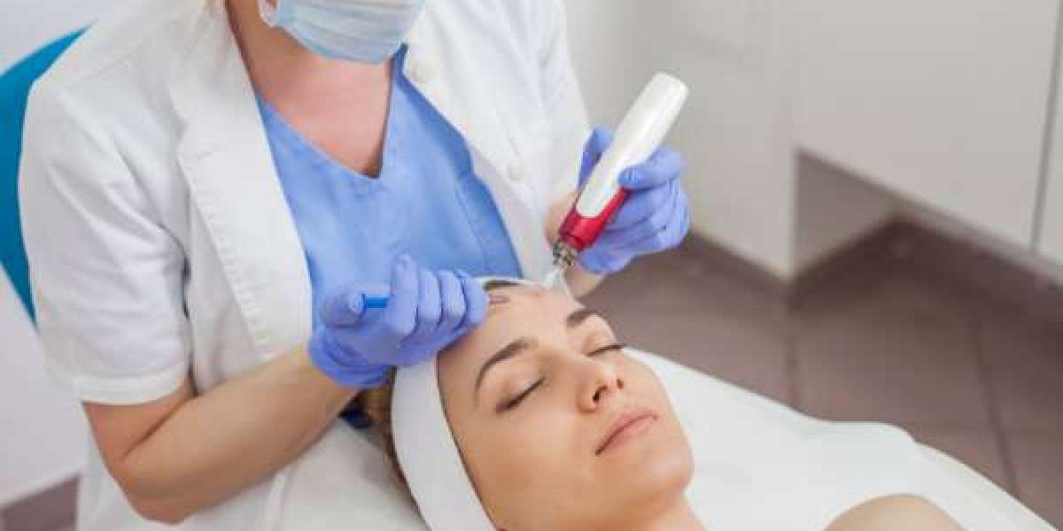 Dazzling in Dubai: The A to Z of Acne Treatment