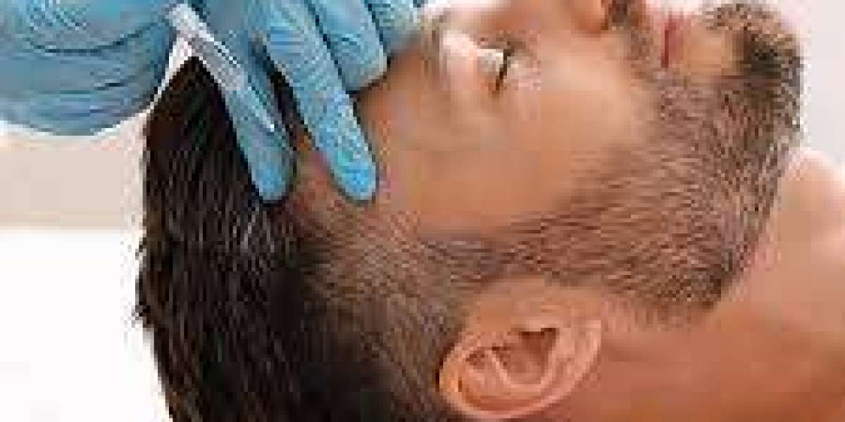 Unlocking Confidence: The Impact of PRP Hair Treatment in Riyadh