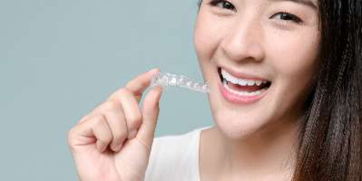 Achieve Your Best Smile with Clear Aligners Near Me Experts