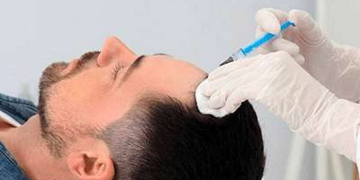 Radiant Revival: ACell PRP Treatment for Hair Loss in Dubai