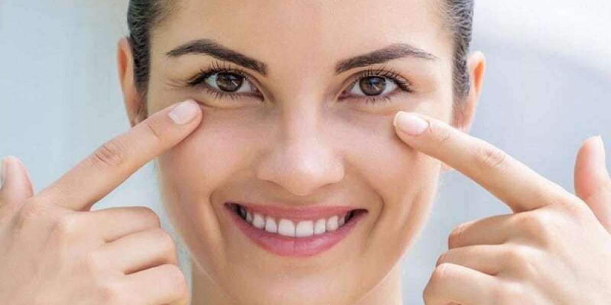 Eyes on the Prize: Unveiling the Best Dark Circles Treatments