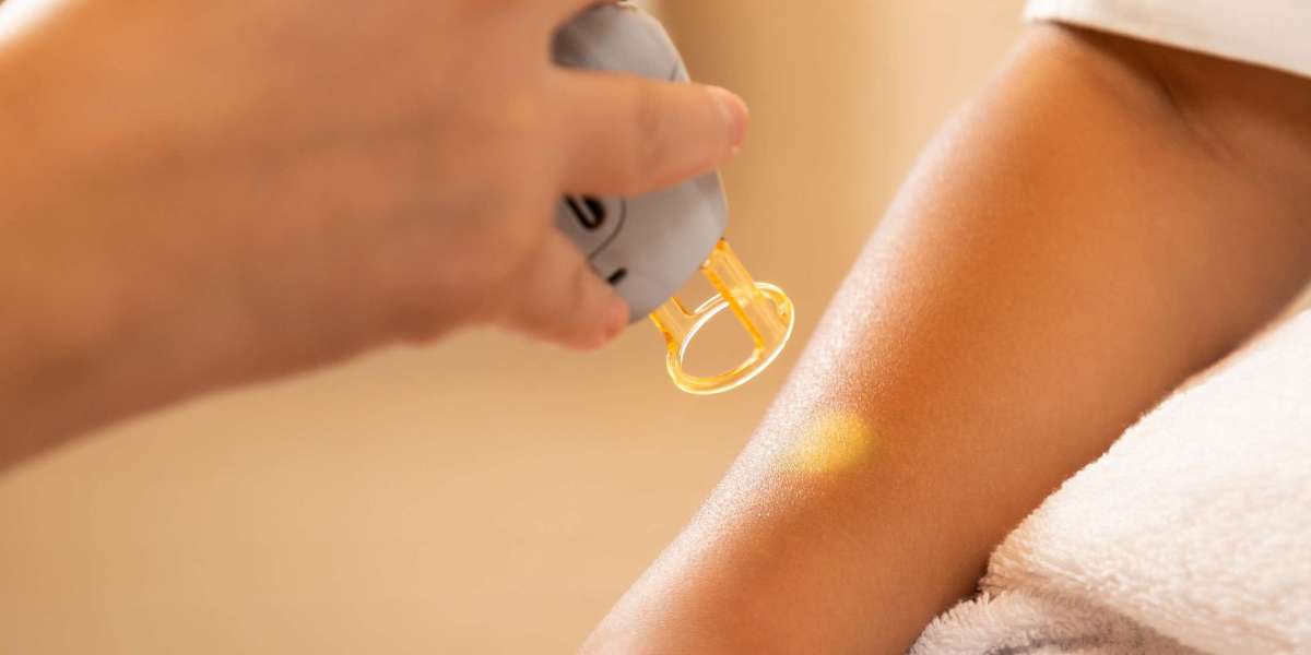 Why Buy Laser Hair Removal Machines?
