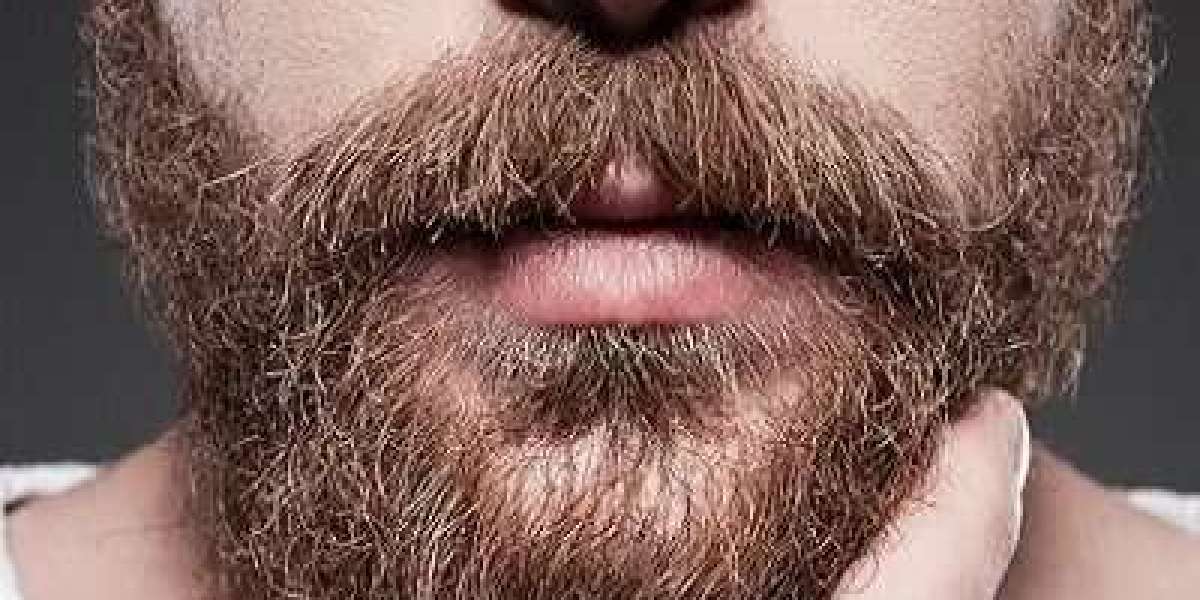 Patchy No More: Embracing Confidence with Beard Hair Transplant Solutions