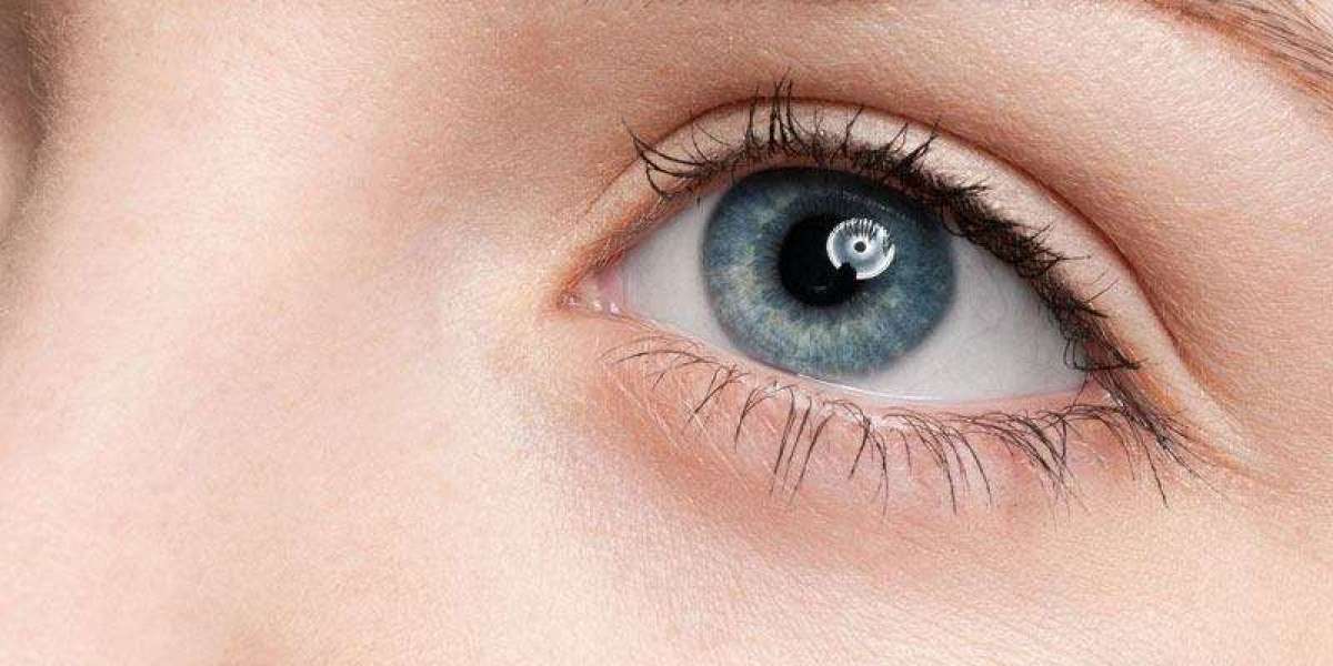 Celestial Eyes: Unlocking Radiance with Under-Eye Fillers in Dubai