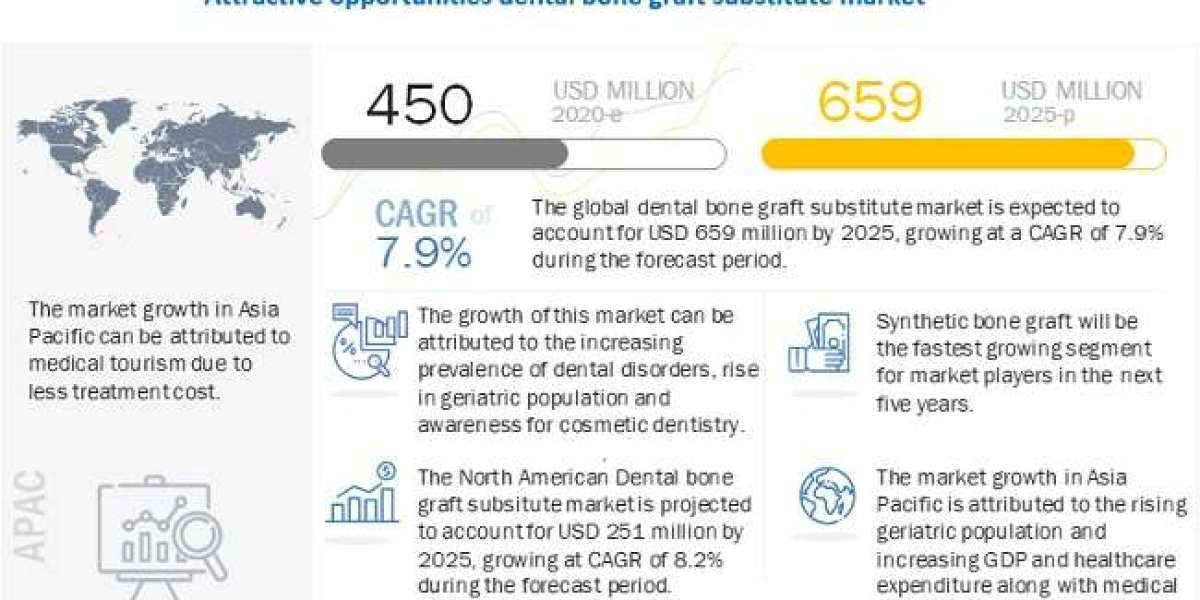 Dental Bone Graft Substitute Market Growth Rate, CAGR, Key Players Analysis Report 2025