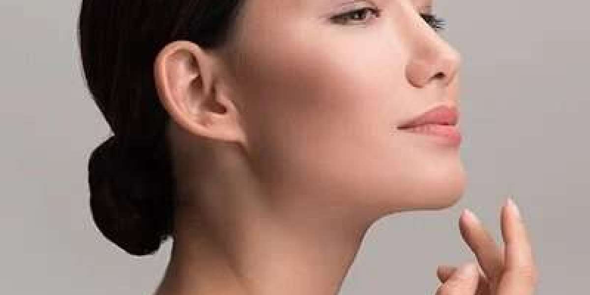Maximizing Results: Combining Chin Liposuction with Facial Exercises