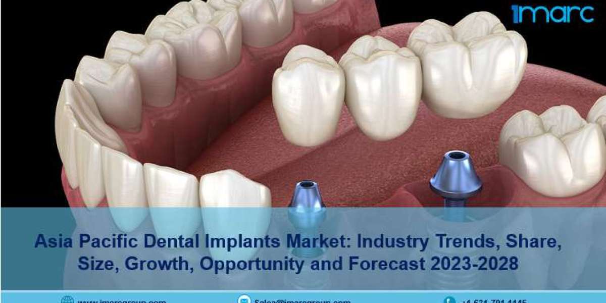 Asia Pacific Dental Implants Market: 2023-2028, Size, Share Trends, Scope And Forecast