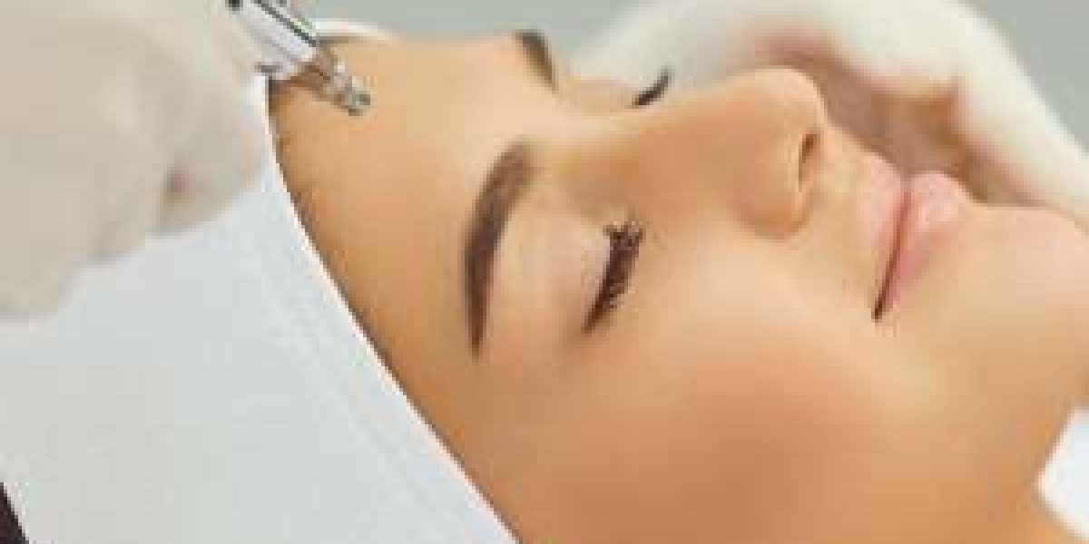 Revitalize Your Skin with Microneedling in Dubai"