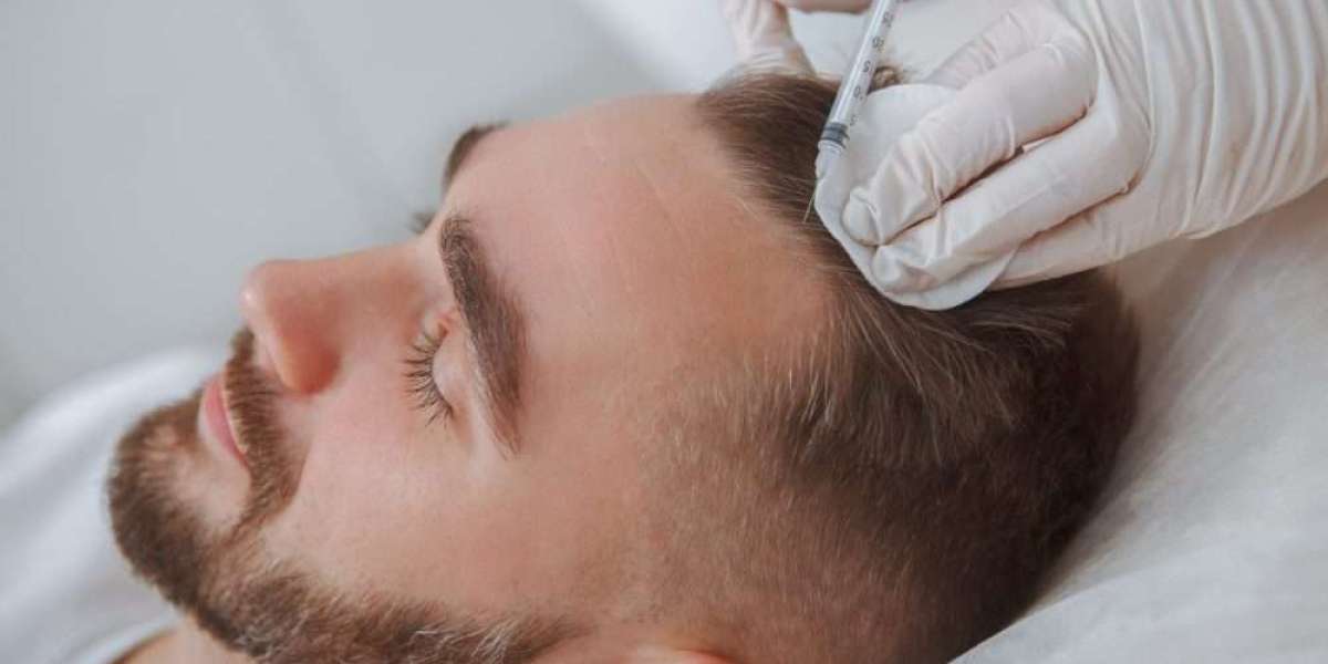 Behind the Scenes: The Surgical Process of Hair Implant in Dubai