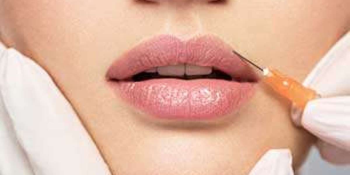 How to Get the Most Out of Botox Lip Flip in Dubai