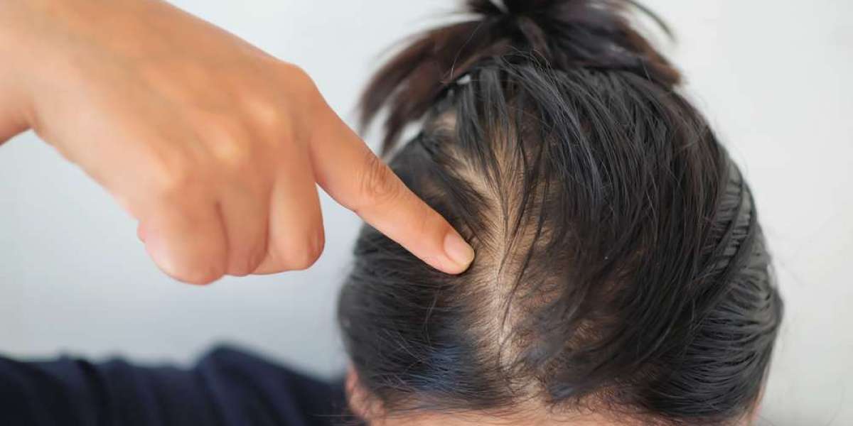 Combat Hair Loss: Advanced Treatments in Dubai Clinics