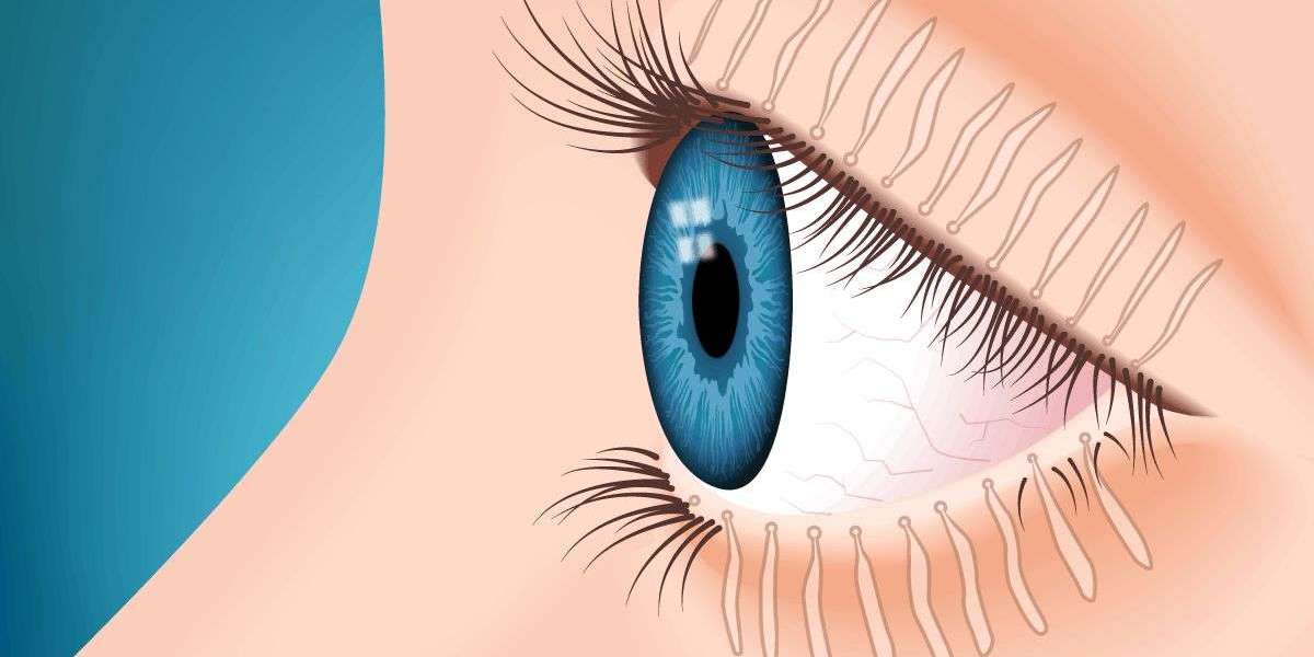 Meibomian Gland Dysfunction Market Report: Epidemiology, Trends and Forecast to (2024-2034)