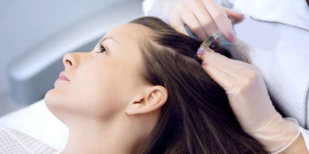 The Ultimate Guide to PRP Hair Treatment in Dubai