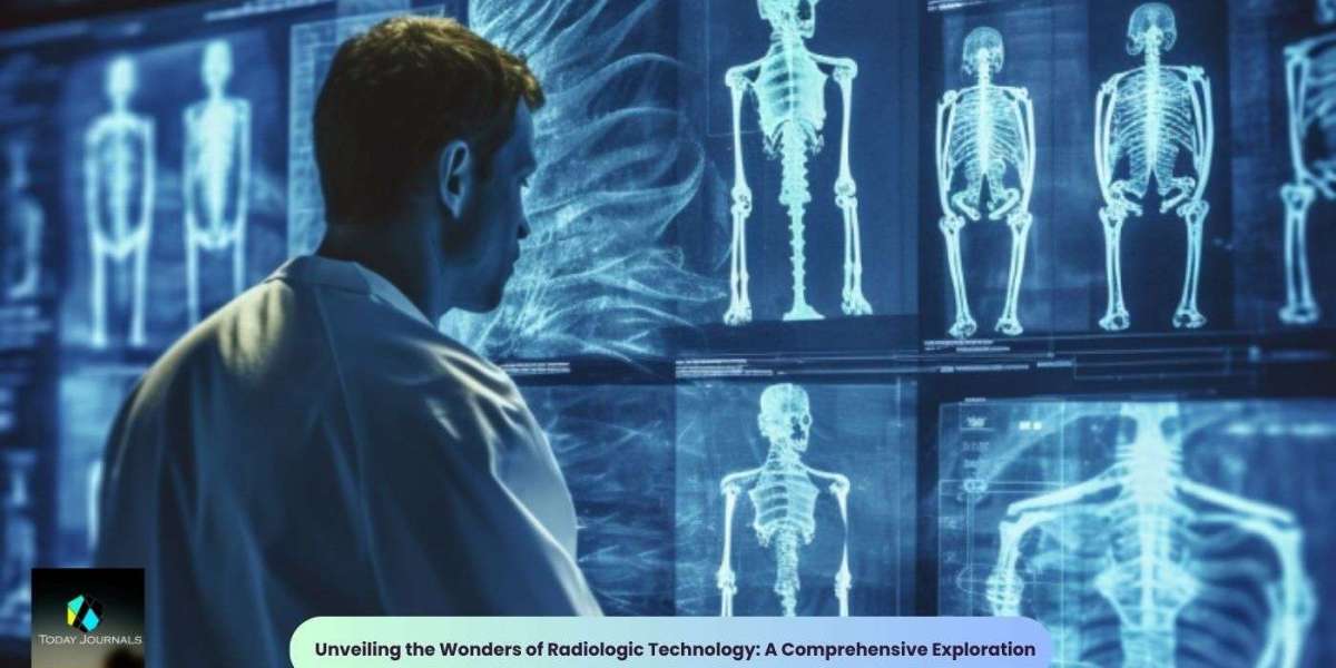 Unveiling the Wonders of Radiologic Technology: A Comprehensive Exploration
