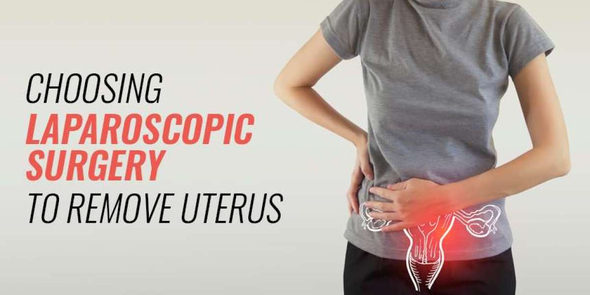 Laparoscopic Surgery to Remove Uterus  | World of Urology