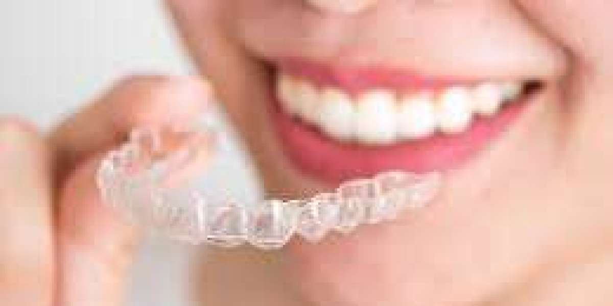 Invisalign for Teens: A Stylish Approach to Orthodontic Care