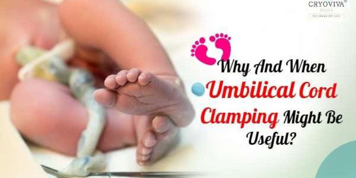 Benefits of Delayed Cord Clamping