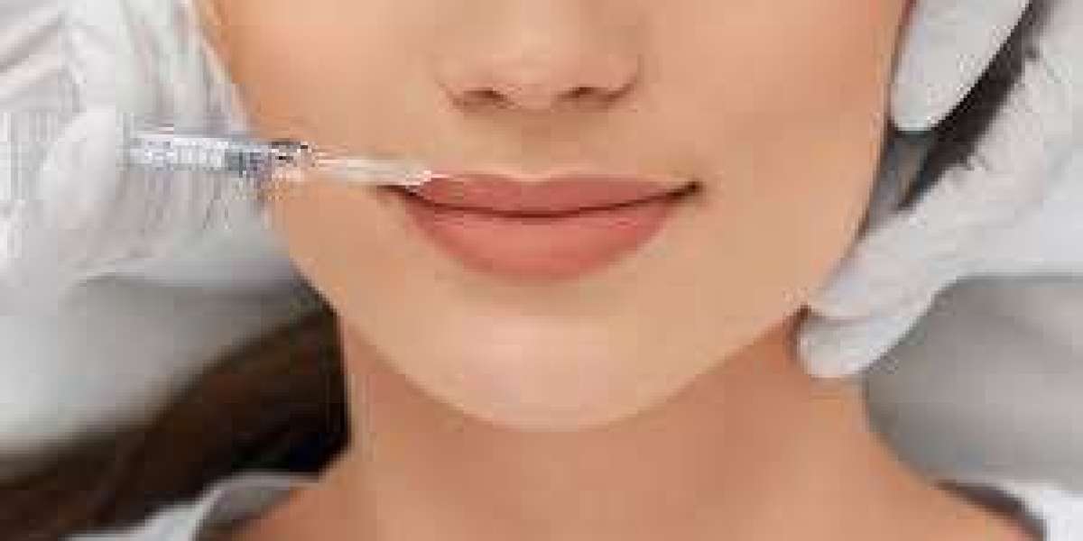 Transform Your Lips with Russian Lip Fillers: Dubai Premier Aesthetic Solution