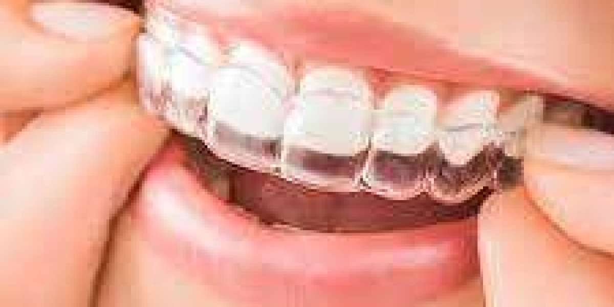 Orthodontic Consultation: What to Expect and Questions to Ask