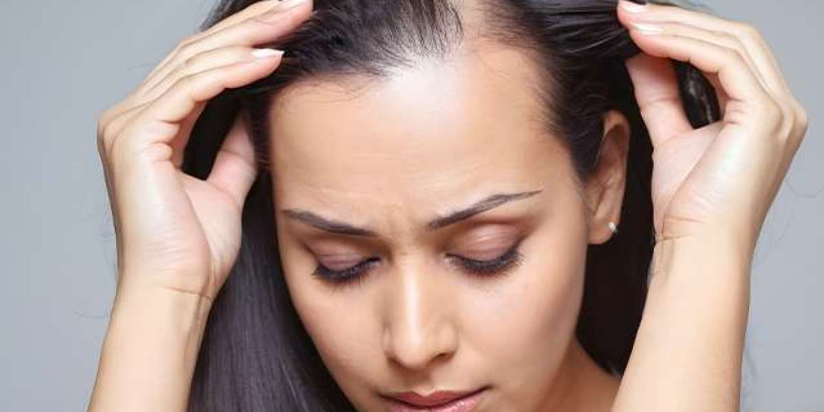 BALDNESS & HAIR LOSS TREATMENT FOR MEN & WOMEN | KOSMODERMA