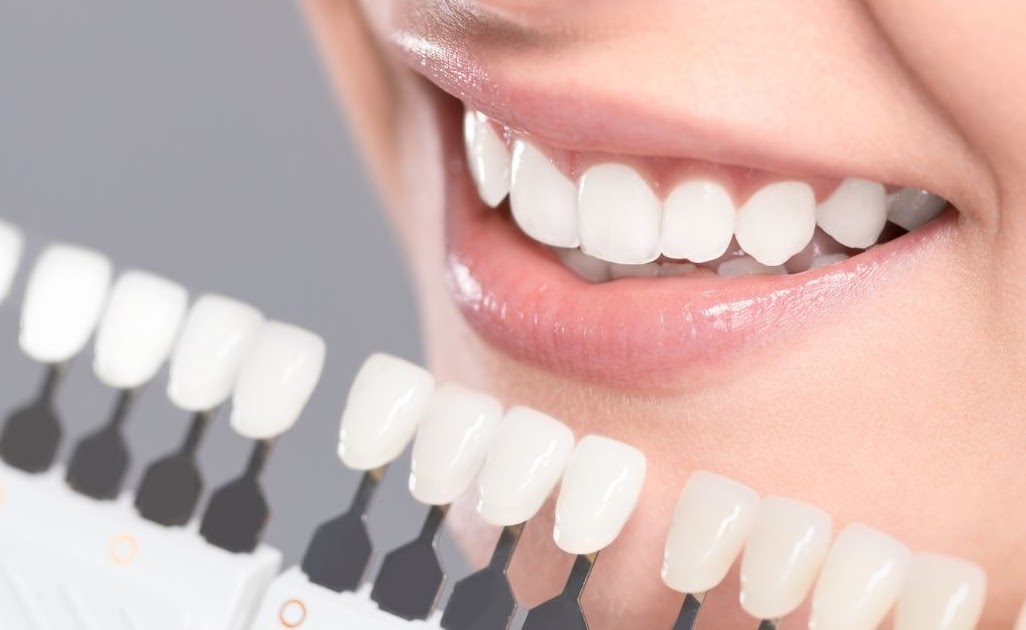 What is the process involved in getting Invisalign?