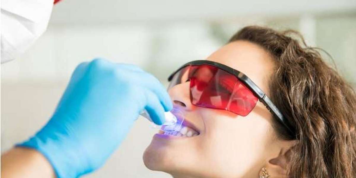 Beyond Whiteness: The Art and Science of Teeth Bleaching in Laguna Niguel