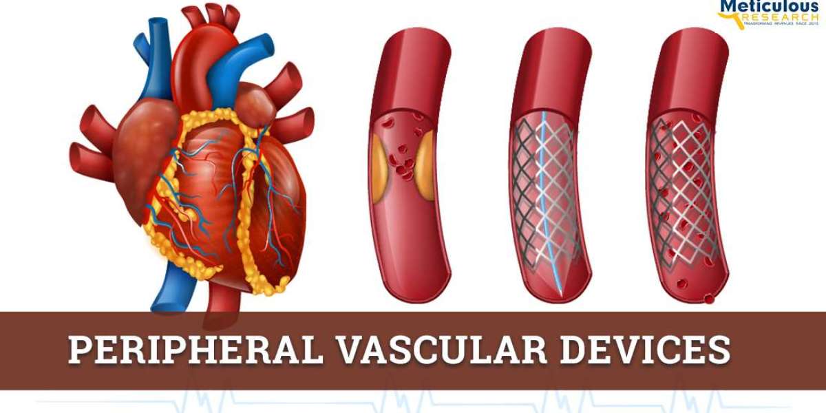Peripheral Vascular Devices Market Worth $12.02 billion by 2028 - by Meticulous Research®