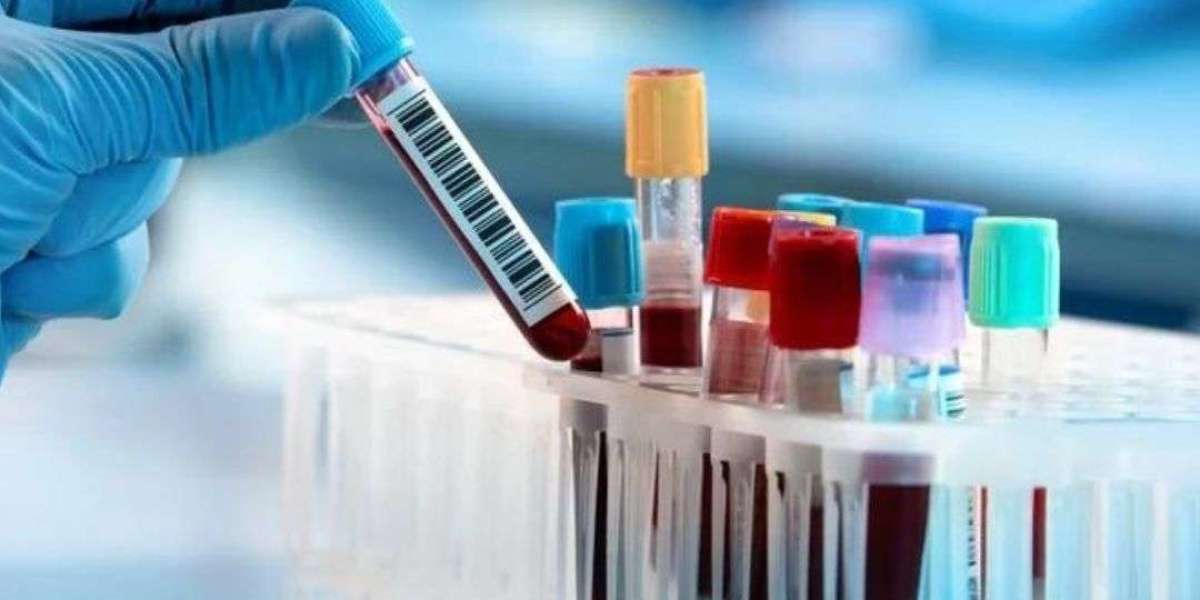 In-Vitro Diagnostics Packaging Market Size, Share, and Research Report 2024-2032
