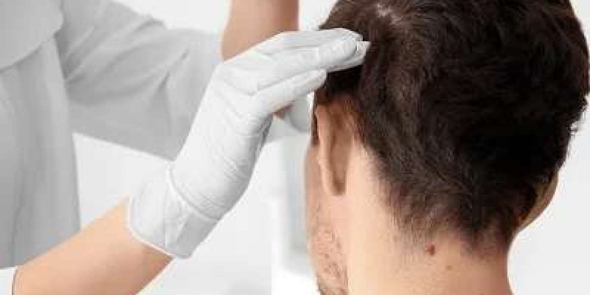 From Balding to Bold: Top Dermatologists Transforming Lives