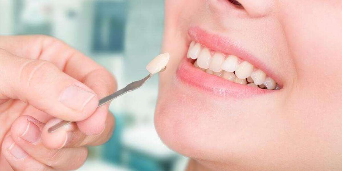 Medicaid Dentistry: Your Guide to Oral Health