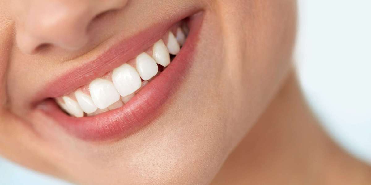 : Porcelain Veneers vs. Other Cosmetic Dentistry Options: Making the Right Choice