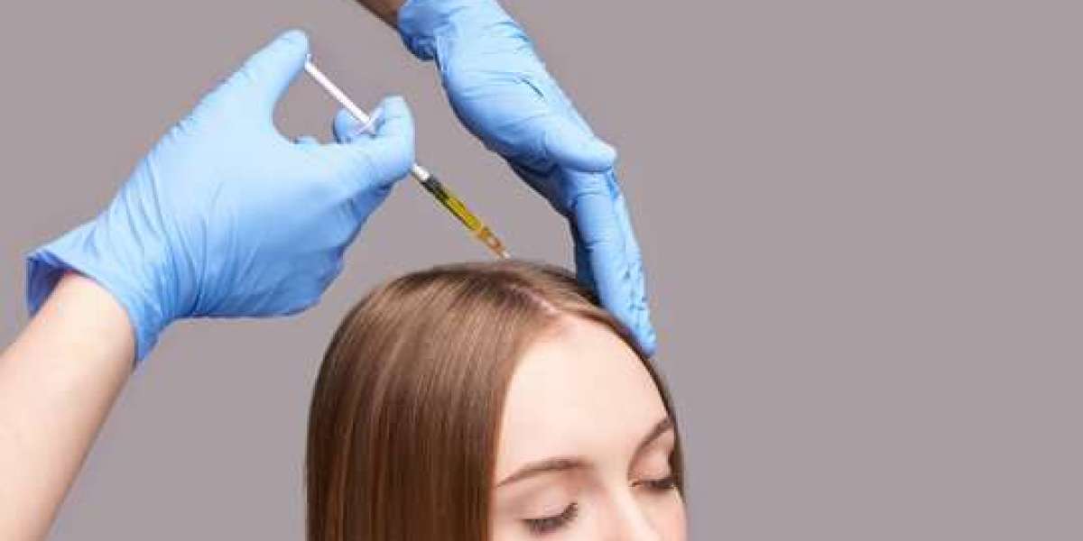 Revive Your Locks: PRP for Hair Loss in Dubai