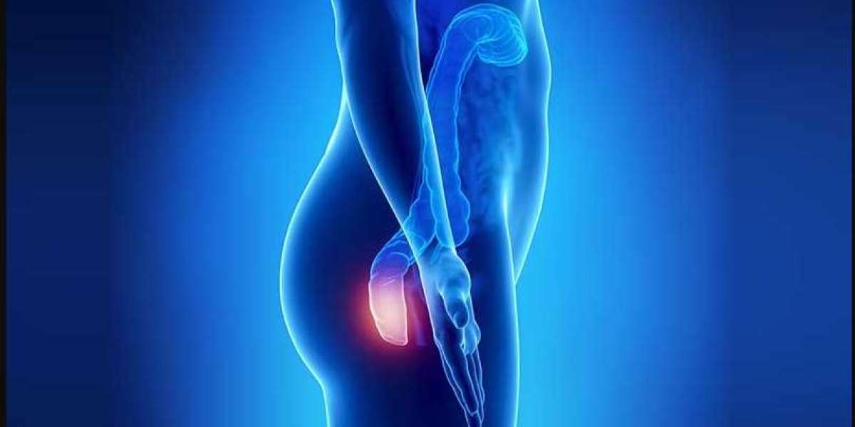 Haemorrhoidal Energy Therapy (HET) Market Analysis, Size, Share, Trends & Forecast 2030