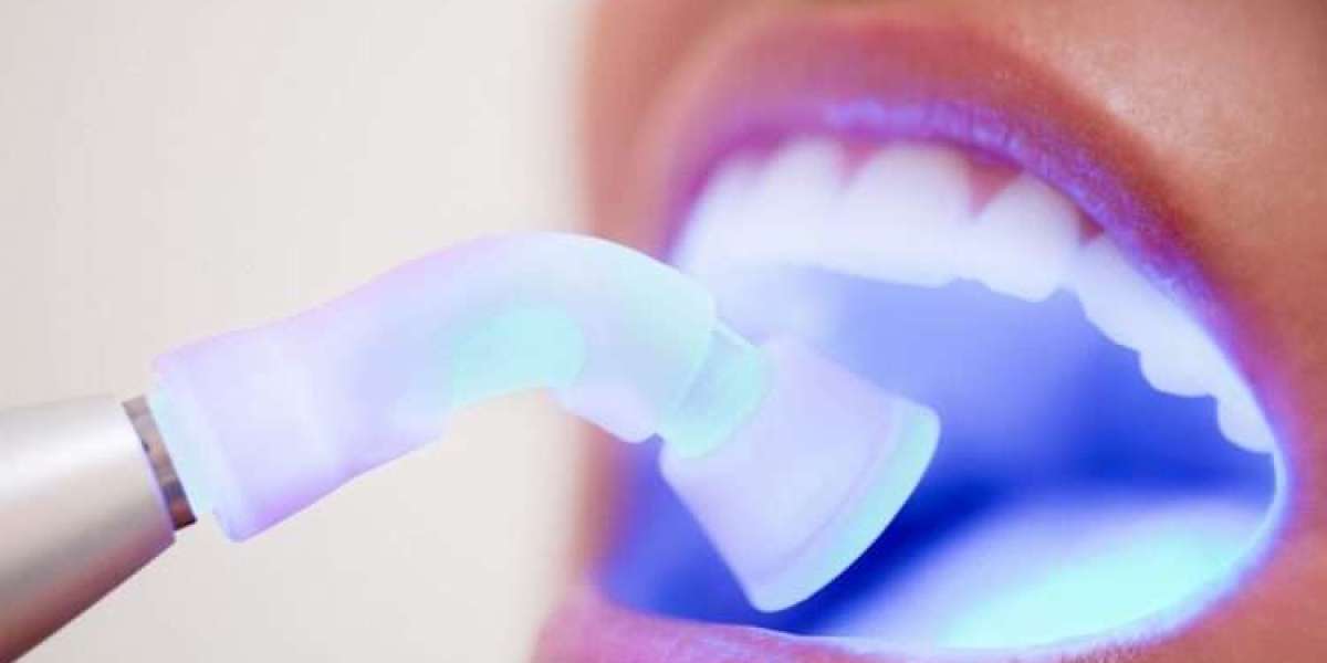 حشوات الأسنان: حل شامل لابتسامة أكثر إشراقًا وصحة