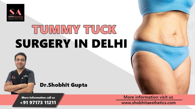 Best Plastic Surgeon in Delhi - Dr Shobhit Gupta on Tumblr: Tummy tuck surgery in Delhi
