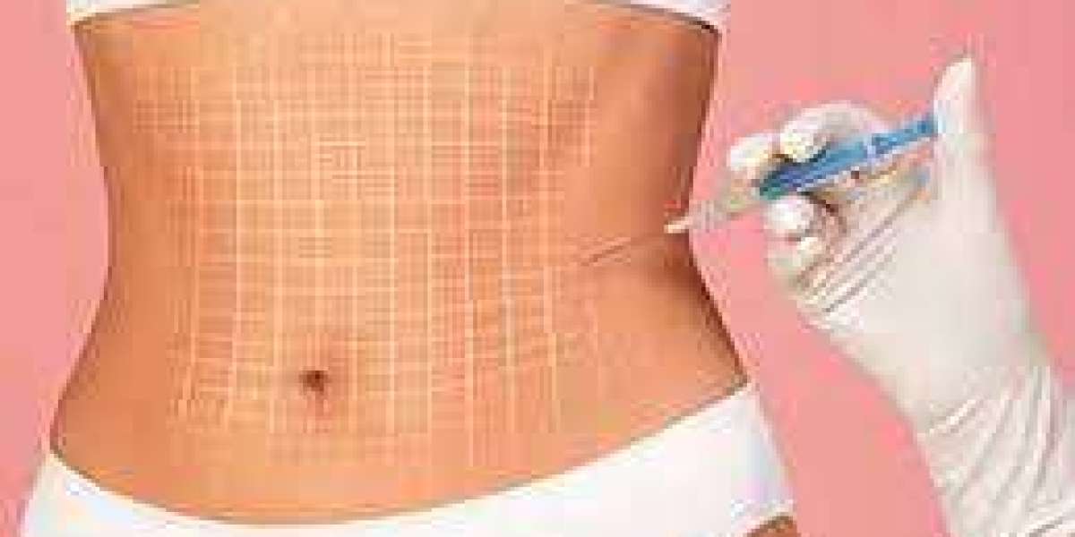 The Rise of Fat Dissolving Needles: A Breakthrough in Non-Surgical Body Contouring