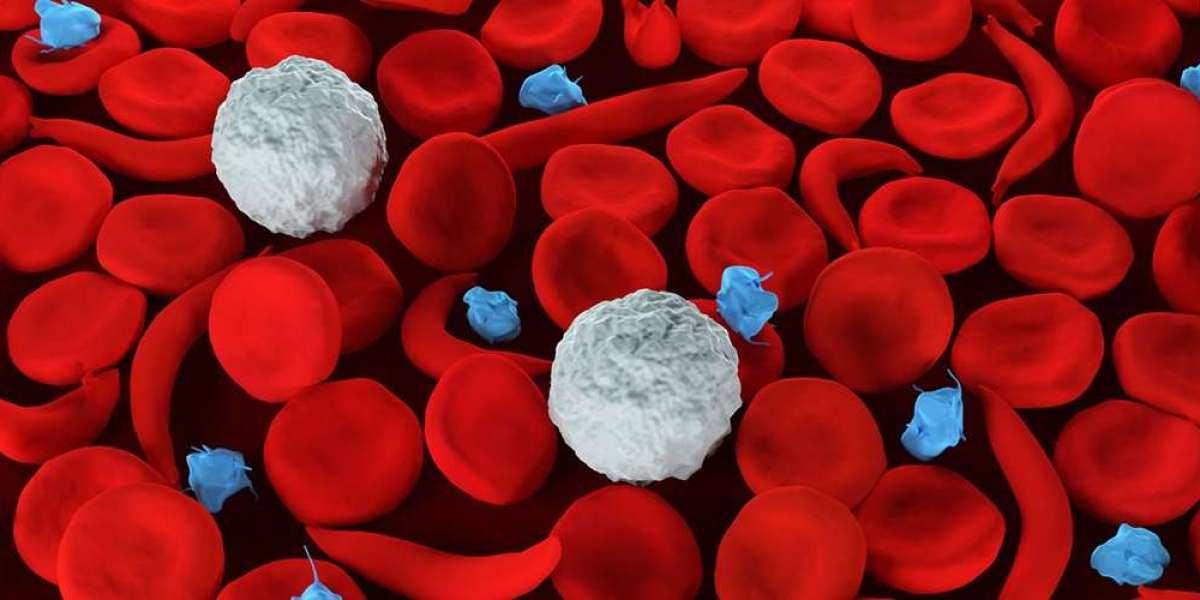 Sickle Cell Disease Treatment Market Growth, Size, Trends, Research Report 2023-2028