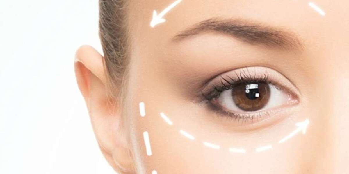 Brow Lift vs. Botox: Which One Reigns Supreme for Youthful Beauty