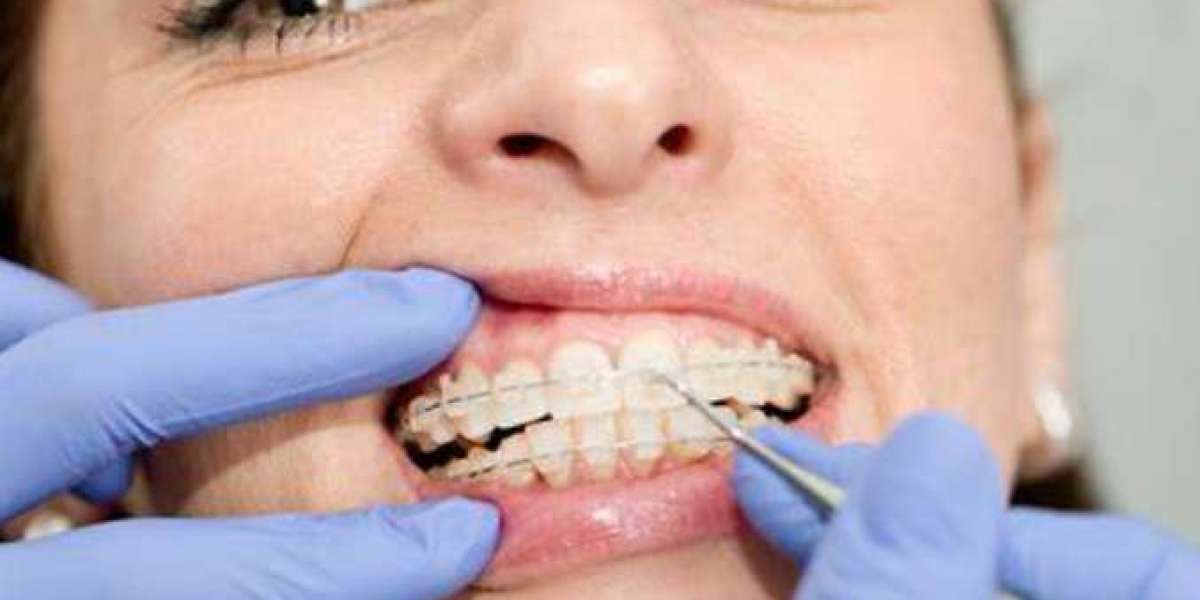 Discovering Excellence in Orthodontic Care: Orthodontist in Farmington, CT