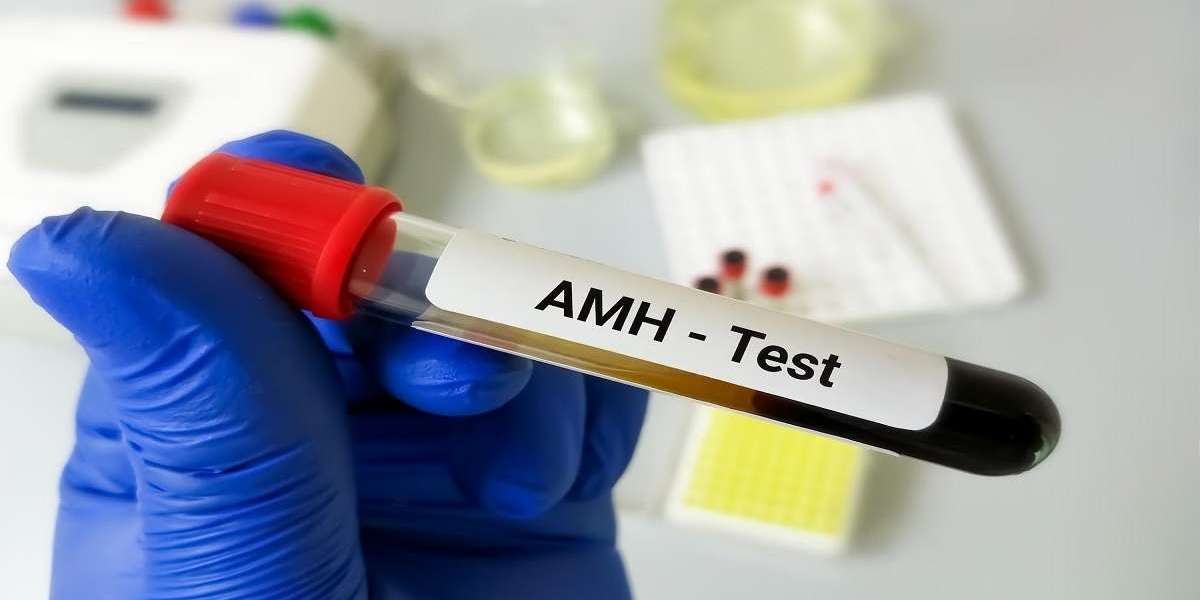 Enhancing Prime IVF Protocols with AMH Profiling