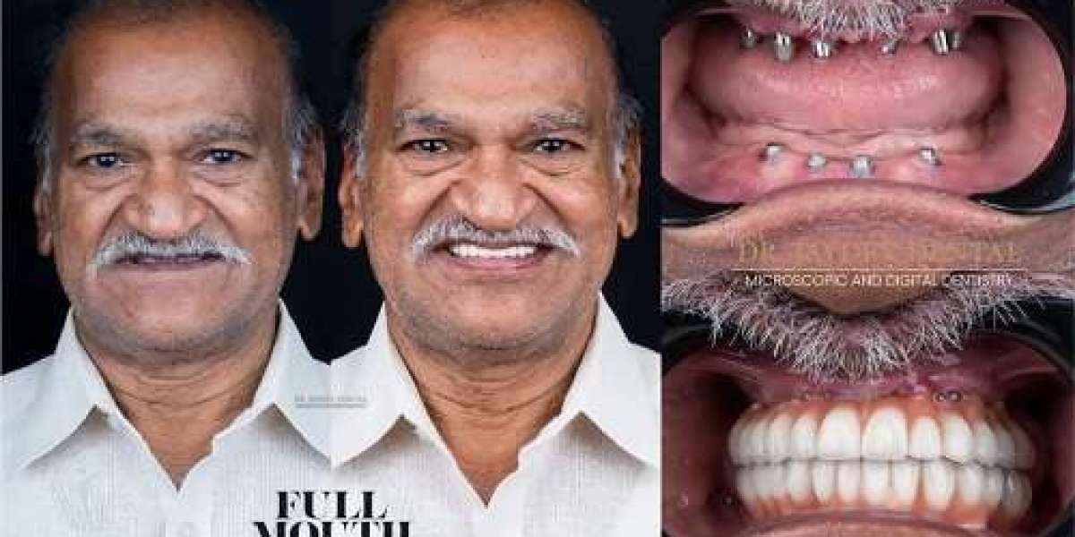 Transforming Smiles: Inside the World of Dental Smile Clinics in India