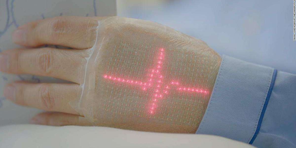 Electronic Skin Market Trends, Growth, and Research Report 2024-2032