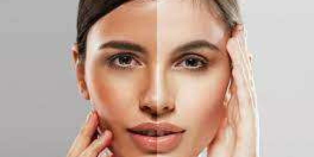 The Fascination with Skin Whitening in Riyadh: Unveiling the Trends, Influences, and Societal Perceptions