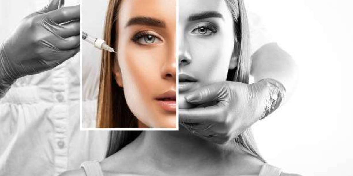 Unveiling Timeless Beauty: Botox Injections in Dubai