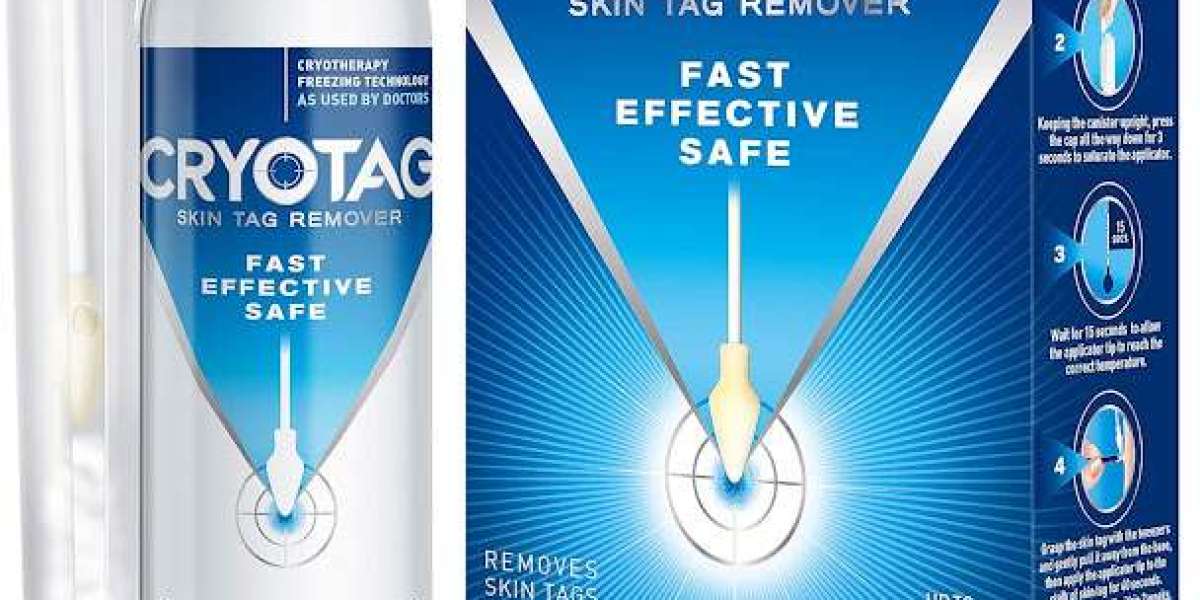 Cryotag Skin Tag Remover UK - Fast Effective And Safe