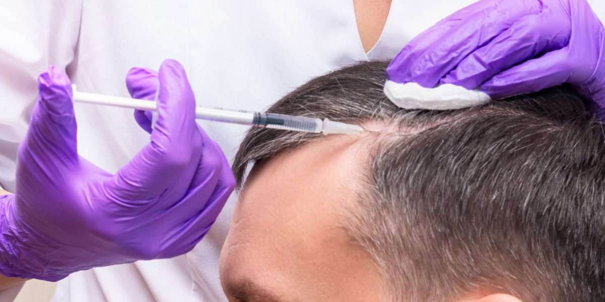 Nourish Your Scalp: Exploring PRP Hair Therapy in Riyadh