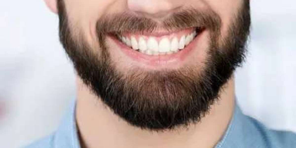 Unlock Confidence: The Complete Guide to Beard Hair Transplant in Dubai